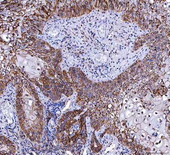 CD147/Emmprin Mouse Monoclonal Antibody