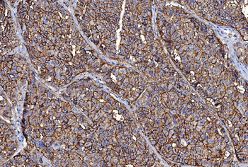 CD147/Emmprin Mouse Monoclonal Antibody