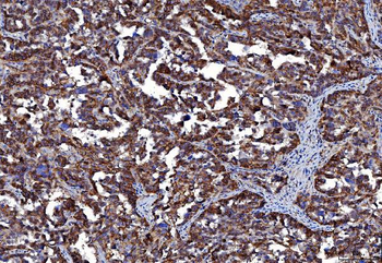 CD147/Emmprin Mouse Monoclonal Antibody