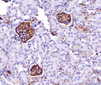 CD147/Emmprin Mouse Monoclonal Antibody