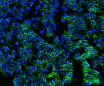 CD147/Emmprin Mouse Monoclonal Antibody