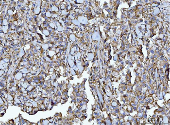 CD147/Emmprin Mouse Monoclonal Antibody