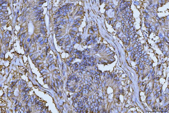 CD147/Emmprin Mouse Monoclonal Antibody