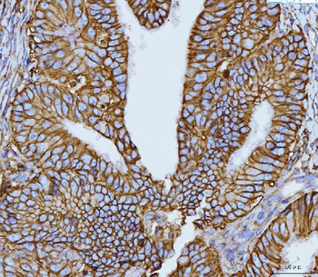 CD147/Emmprin Mouse Monoclonal Antibody