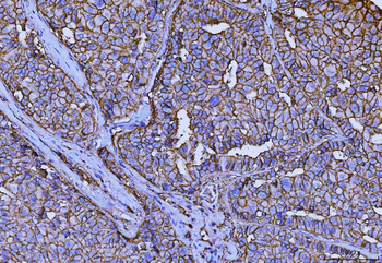 CD147/Emmprin Mouse Monoclonal Antibody