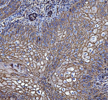 CD147/Emmprin Mouse Monoclonal Antibody