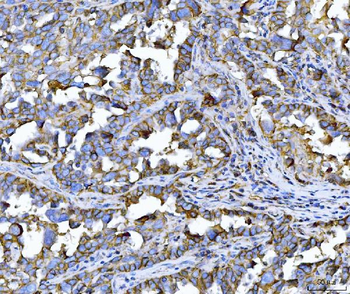 CD147/Emmprin Mouse Monoclonal Antibody