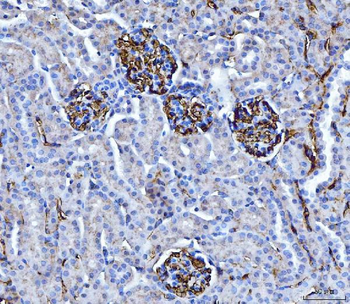CD147/Emmprin Mouse Monoclonal Antibody