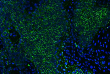 CD147/Emmprin Mouse Monoclonal Antibody