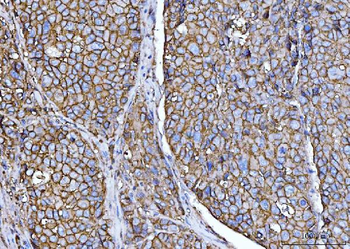 CD147/Emmprin Mouse Monoclonal Antibody