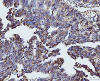 CD147/Emmprin Mouse Monoclonal Antibody