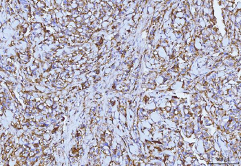 CD147/Emmprin Mouse Monoclonal Antibody