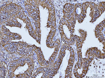 CD147/Emmprin Mouse Monoclonal Antibody