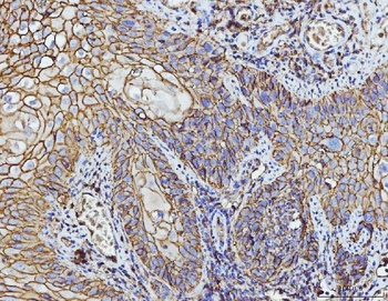 CD147/Emmprin Mouse Monoclonal Antibody