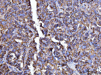 CD147/Emmprin Mouse Monoclonal Antibody