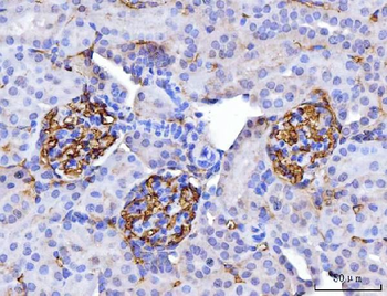 CD147/Emmprin Mouse Monoclonal Antibody