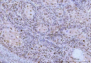 Cdk2 Mouse Monoclonal Antibody