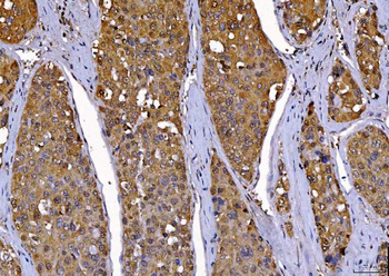 Cdk2 Mouse Monoclonal Antibody