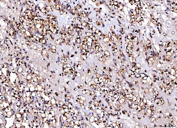Cdk2 Mouse Monoclonal Antibody