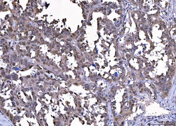Cdk2 Mouse Monoclonal Antibody