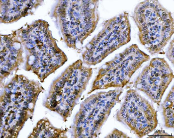 Cdk2 Mouse Monoclonal Antibody