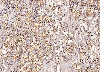 Sorbitol Dehydrogenase/SORD Mouse Monoclonal Antibody