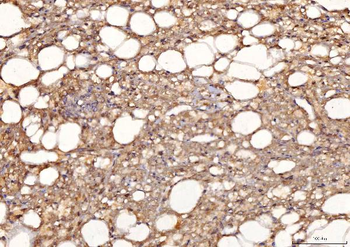 Sorbitol Dehydrogenase/SORD Mouse Monoclonal Antibody