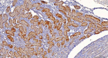Sorbitol Dehydrogenase/SORD Mouse Monoclonal Antibody