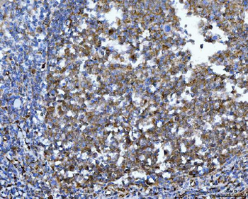 YWHAE Mouse Monoclonal Antibody