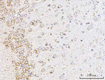 YWHAE Mouse Monoclonal Antibody