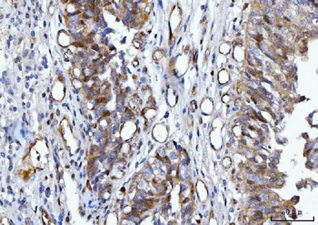 YWHAE Mouse Monoclonal Antibody