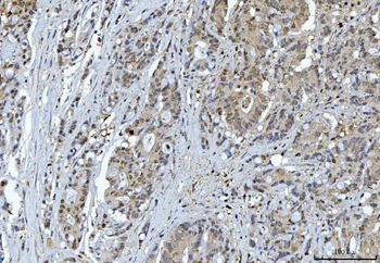 YWHAE Mouse Monoclonal Antibody