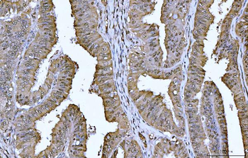 YWHAE Mouse Monoclonal Antibody