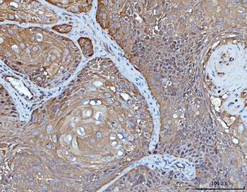 YWHAE Mouse Monoclonal Antibody