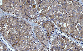 YWHAE Mouse Monoclonal Antibody