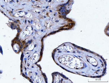 YWHAE Mouse Monoclonal Antibody
