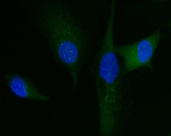 HGS Mouse Monoclonal Antibody