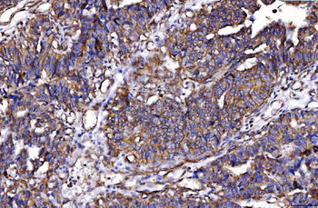 HGS Mouse Monoclonal Antibody