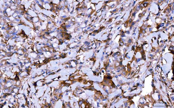 HGS Mouse Monoclonal Antibody