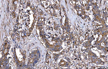 HGS Mouse Monoclonal Antibody