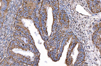 HGS Mouse Monoclonal Antibody