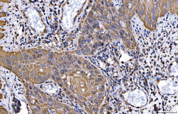 HGS Mouse Monoclonal Antibody