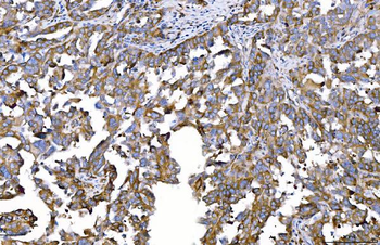 HGS Mouse Monoclonal Antibody