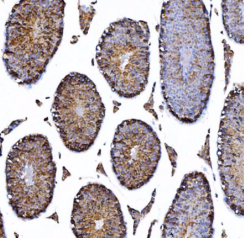 HGS Mouse Monoclonal Antibody