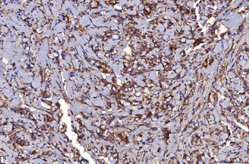 HGS Mouse Monoclonal Antibody