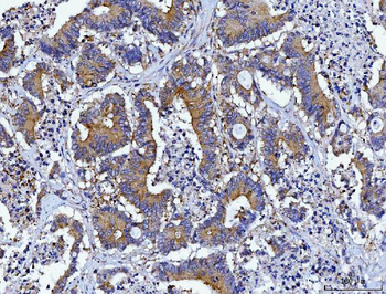 HGS Mouse Monoclonal Antibody