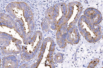 HGS Mouse Monoclonal Antibody