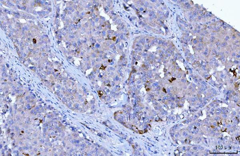 HGS Mouse Monoclonal Antibody