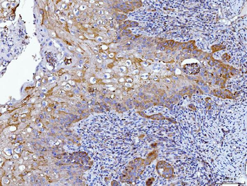 HGS Mouse Monoclonal Antibody