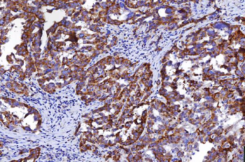 HGS Mouse Monoclonal Antibody